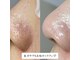 ベリッシマ(Bellissima)の写真