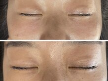 ラヴィ(Ravi)/目元ケア