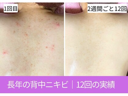 おうちサロン ミキの写真