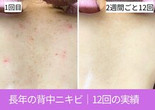 おうちサロン ミキ