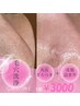 【毛穴黒ずみ&ガサガサ肌卒業】 ピーリング毛穴洗浄45分 ¥4000→¥3000
