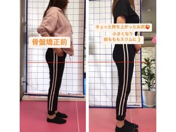 くまがい整体院 若松店/骨盤矯正