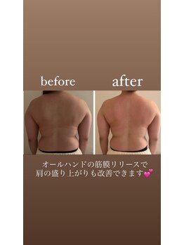 ウララカ(uraraka)/