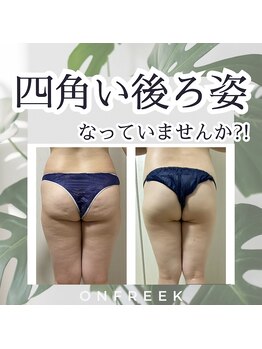 オンフリーク(ONFREEK)/ハイパーナイフ　Body