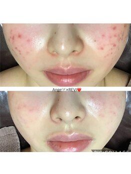 アンジュヴィバラヴィーダ(Ange viva la vida)/