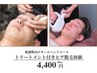 【敏感肌向け】　トリート付きヒゲ全体の脱毛体験
