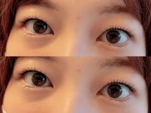 ユーロ(EURO)/ラッシュリフト／まつ毛パーマ