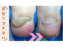 巻き爪補正店 那覇店/