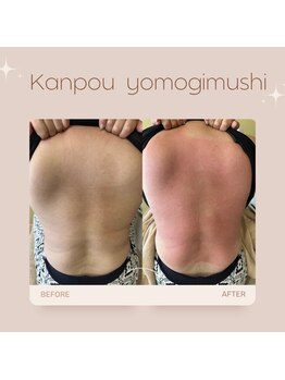 エミュ(emu)/トーンヌール★施術後の変化！