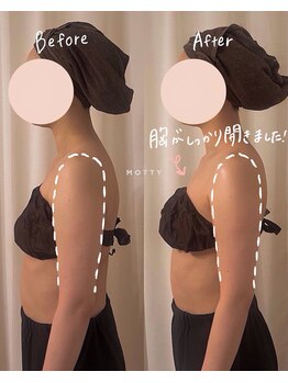 モッティ(MOTTY)/