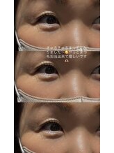 ビューティマーケット アングゥ(BEAUTY MARKET ungu)/パリジェンヌラッシュリフト