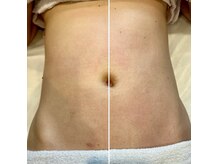 レイ(Rei)の雰囲気(ヒーリングリンパ+ウエストリンパ施術でくびれボディ)