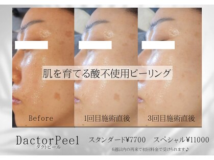 メイプル(Maple)の写真