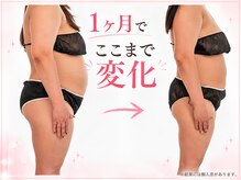 ヨサパーク アカーシャ(YOSA PARK AKASHA)/1ヶ月でここまで変化！