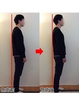 整体院プラス/猫背矯正モニター