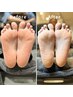 【フットネイル】フットケア(足裏の角質・ネイルケア)　4950円→4500円！