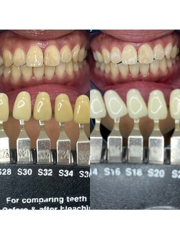 トウキョウスワーズ 池袋店(TOKYO SWRS)/#ホワイトニング #池袋 #渋谷