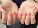 cheek nail