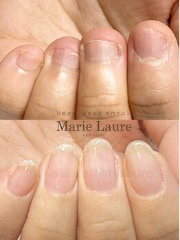 マリーロール 淀屋橋本店(Marie Laure)/自爪育成/深爪矯正/ネイルケア
