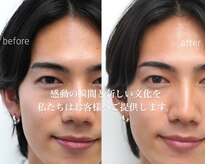 アイアンドコー(EYE&Co.)