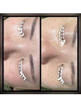 ココスタイルビューティー(COCOSTYLE beauty)/シミ改善し放題