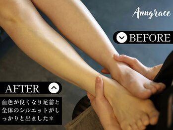 アングレイス(Anngrace)/【優雅の極み】美脚は造れる*