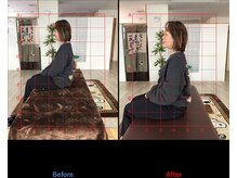 ストレチックス 近江八幡店/BeforeAfter