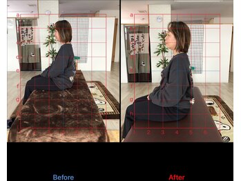 ストレチックス 近江八幡店/BeforeAfter
