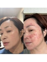 ベル(Bell)/ダイヤモンドスピキュール