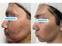 アスポーテ(ASBEAUTE)の雰囲気（メンズフェイシャルやってます！男性のお客様急増化中です！！）