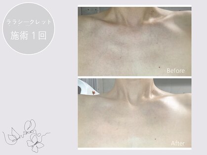 エクラルム(Eclaleum)の写真