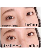 アズール(AZUL)/まつ毛パーマ