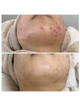 ビューティーホリック 蘇我店(BEAUTY HOLIC)/