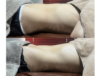アディ(Adiy)の写真/【脳腸相関に基づいて不調を解消】痩せたい人集合！腸もみで全身が整う！腰痛改善で姿勢ケアまで行き届く◎