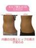 無料カウンセリング【腸タイプ診断】×【腸もみスタンダードコース施術体験】