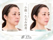 エフリア 大垣(F.lia)
