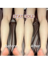 ステイゴールド 新百合ヶ丘(STAY GOLD)/足脱毛！2回目☆