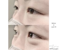 アトリエ プラス リム(atelier +LIM)/ラッシュリフト/まつげパーマ