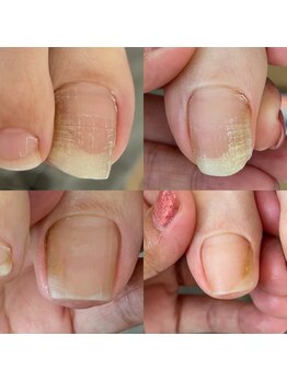 ウェルズユキ(well's yuki)/