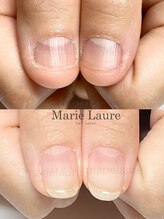 マリーロール 淀屋橋本店(Marie Laure)/自爪育成/深爪矯正/ネイルケア