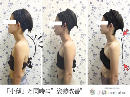 小顔フェイスラボ 栄店(小顔Face Labo.)の写真