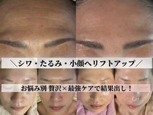 ルミア(LUMIA)の雰囲気（小顔リフトアップ/毛穴/シワたるみを徹底ケアで褒められ美肌へ。）