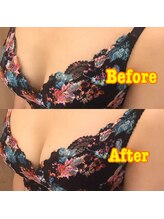 エステティック レイビス 池袋店(RAYVIS)/ブライダル