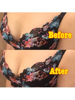 エステティック レイビス 池袋店(RAYVIS)/ブライダル