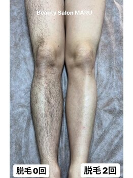 ビューティーサロン マル(Beauty Salon MARU)/