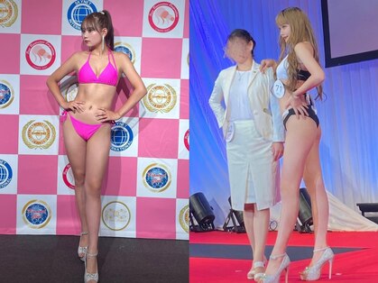 キララ(Kirara)の写真