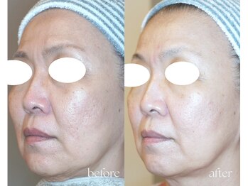 岩川治療院/50代半ば 女性のお客様