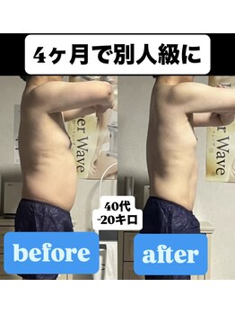 痩身ハイパーナイフメンズ【salon blue rose】新栄町/千種/痩身/ダイエット/脂肪燃焼/痩身ハイパーナイフメンズ