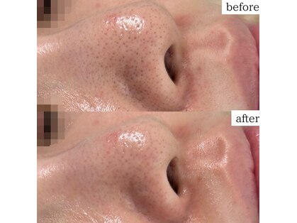 ルポ(RUPO)の写真