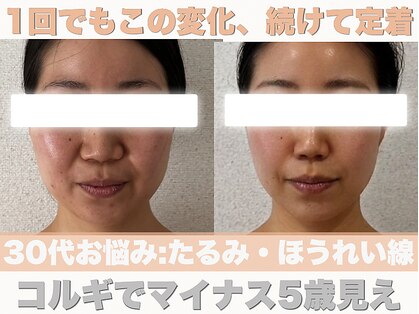 ナーナモエ(na-namoe)の写真